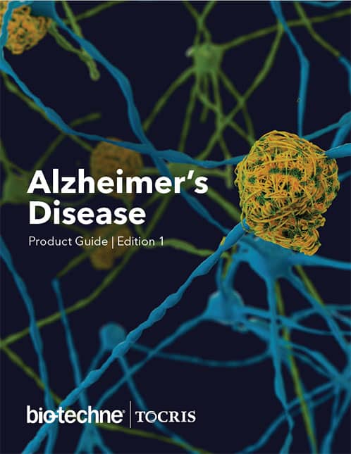 research about alzheimer's disease