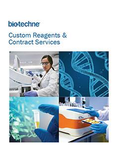 Custom Reagents & Contract Services