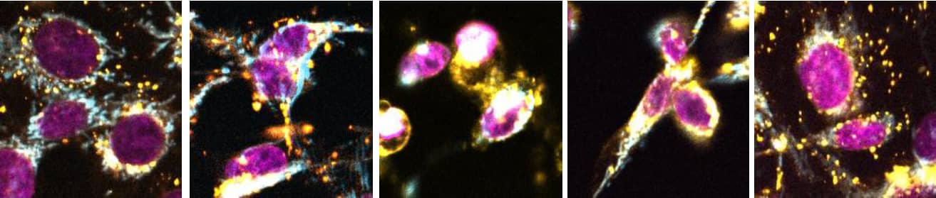 MCF-7 cells with ChromaLIVE™ Deep Red and NucleoLIVE™ Red