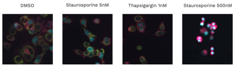 MCF-7 cells with ChromaLIVE at 24h in different conditions MCF-7 cells with ChromaLIVE at 24h in different conditions