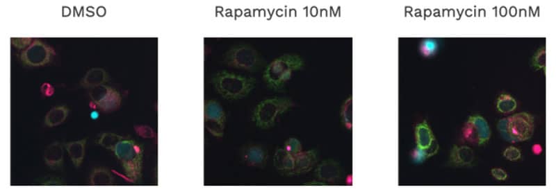MCF-7 cells with ChromaLIVE at 72h treated with Rapamycin MCF-7 cells with ChromaLIVE at 72h treated with Rapamycin