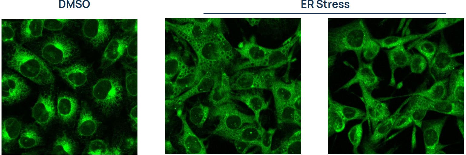 MCF7 cells stained with ER-LIVE™ MCF7 cells stained with ER-LIVE™