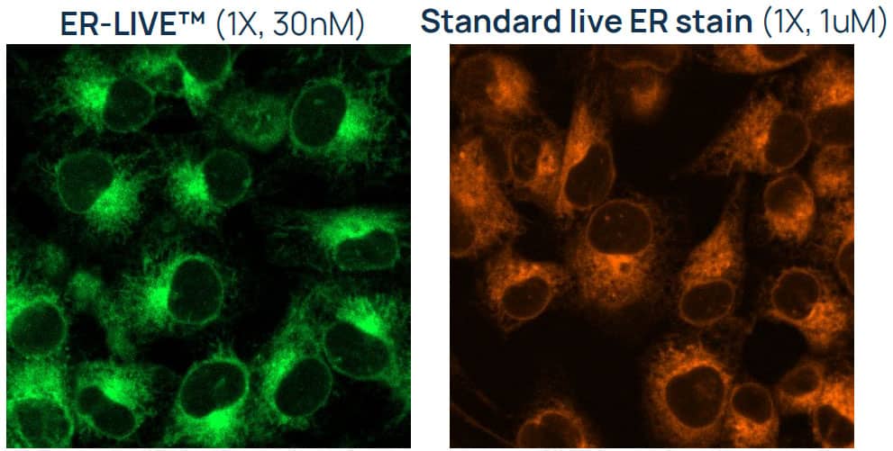ER-LIVE™ delivers bright, stable endoplasmic reticulum labeling at
nanomolar concentrations, minimizing disruption of native cell biology. ER-LIVE™ delivers bright, stable endoplasmic reticulum labeling at
nanomolar concentrations, minimizing disruption of native cell biology.
