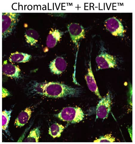 ER-LIVE™ multiplexed with ChromaLIVE™ and NucleoLIVE™ ER-LIVE™ multiplexed with ChromaLIVE™ and NucleoLIVE™