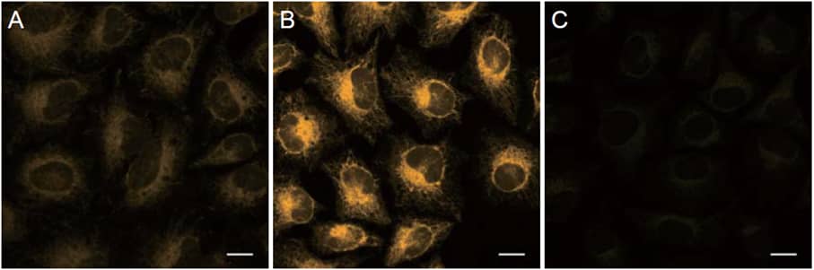 Detection of intracellular Fe2+ in HeLa cells in cells using FerroOrange