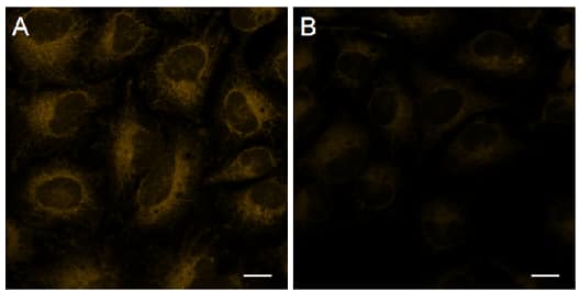 Detection of intracellular Fe2+ in HeLa cells in cells using FerroOrange